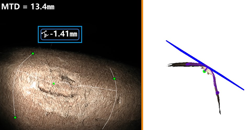案例2:測(cè)量渦輪葉片前緣弧面凹坑